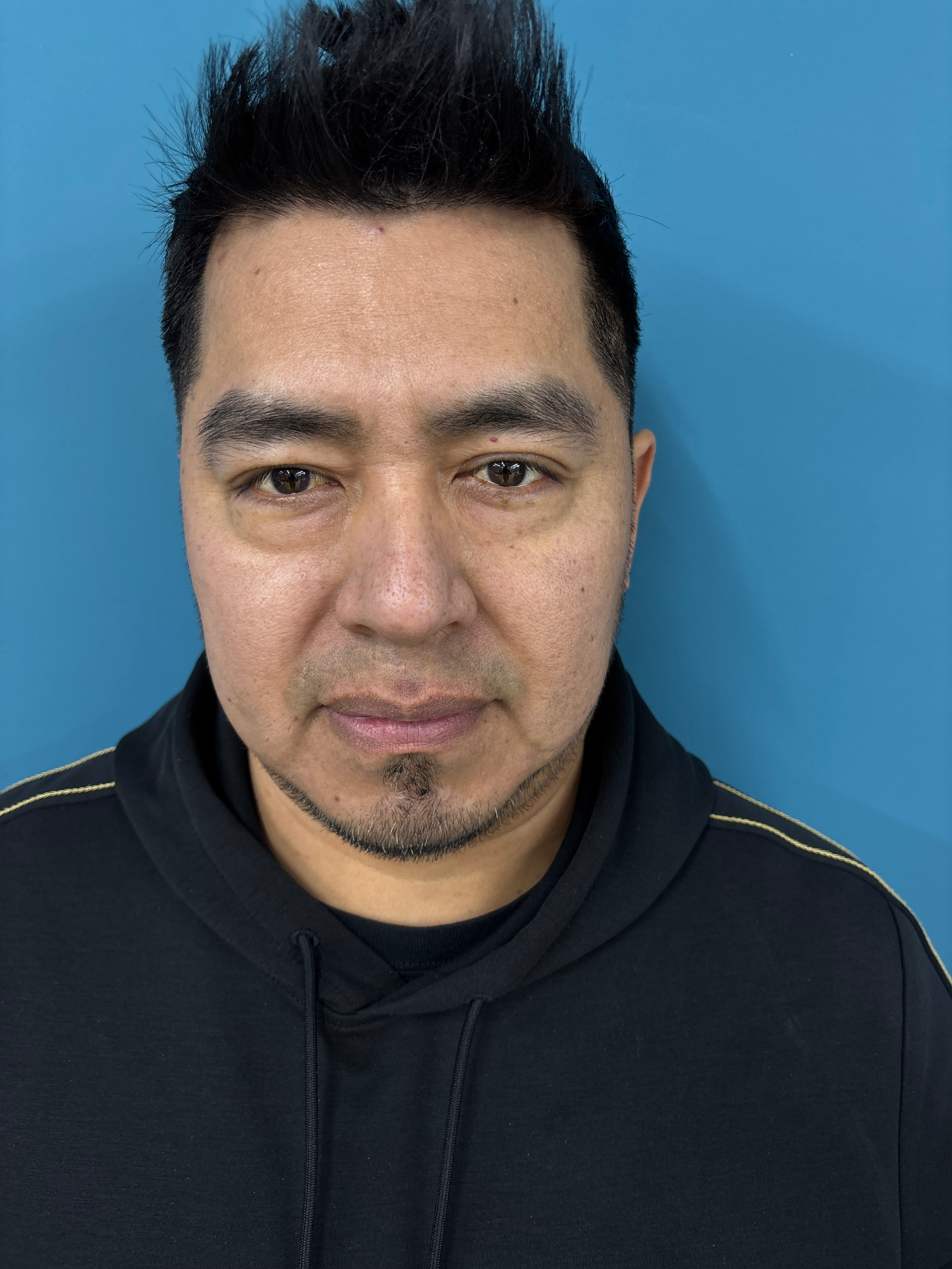 JOSE MARTINEZ RONZON